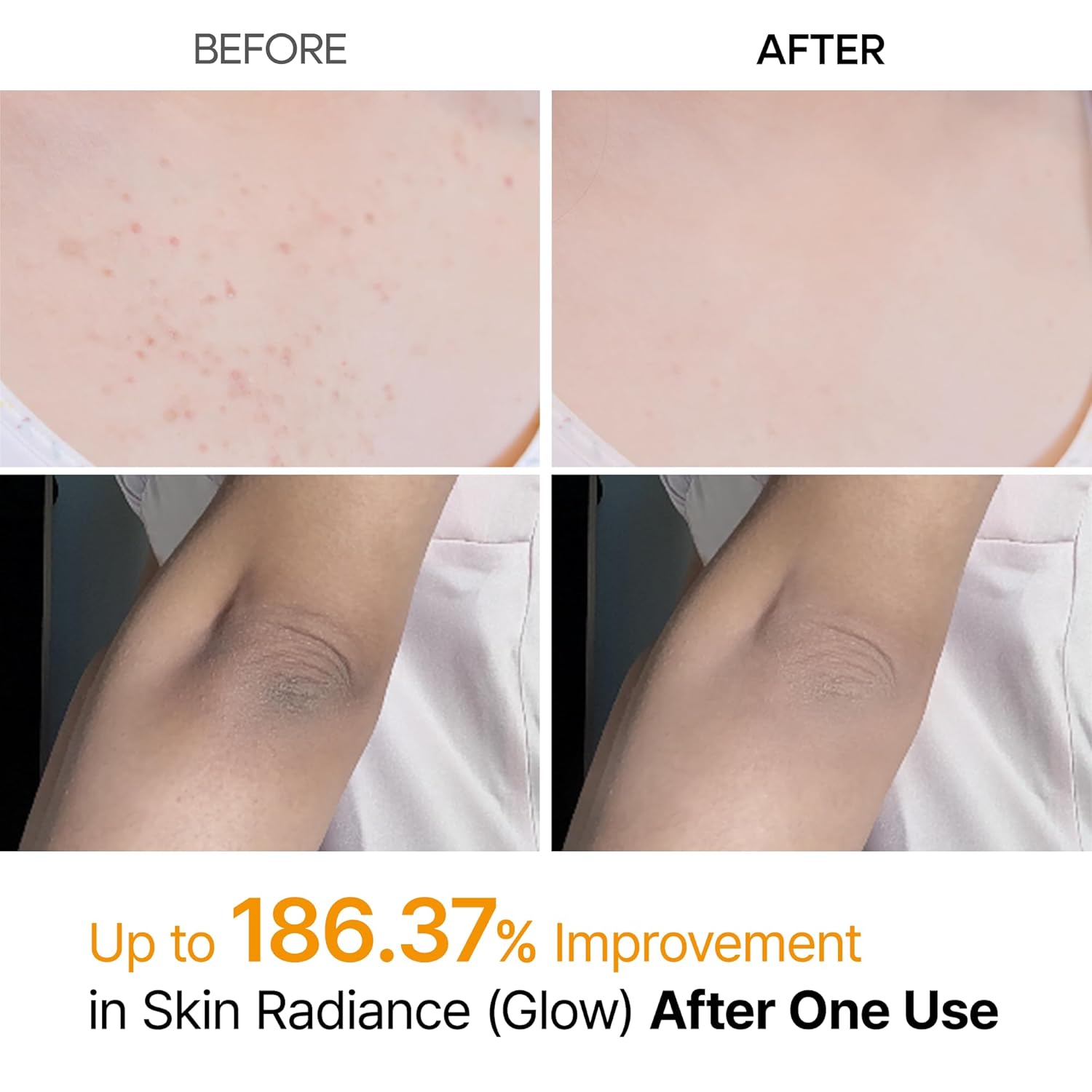 Dr.Melaxin Body Keratin Care Kojic Acid Turmeric Spray with AHA & PHA, Gentle Body Brightening & Exfoliating Peeling Solution for Dead Skin Cells & Texture, Korean Skincare, 6.76 fl.oz