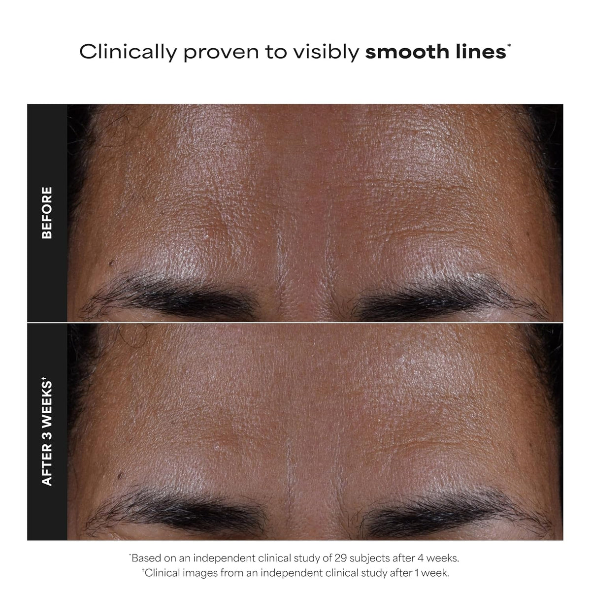 Paula's Choice SKIN PERFECTING 2% BHA Liquid Exfoliant with Salicylic Acid, Facial Polish for Enlarged Pores, Wrinkles & Fine Lines, Suitable for Blackhead-Prone Skin, Fragrance-Free